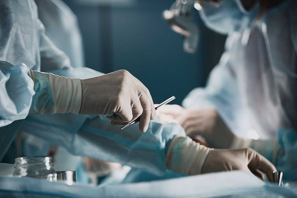 Image hover effect image