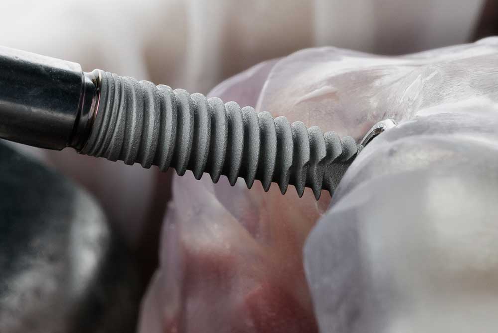 Image hover effect image