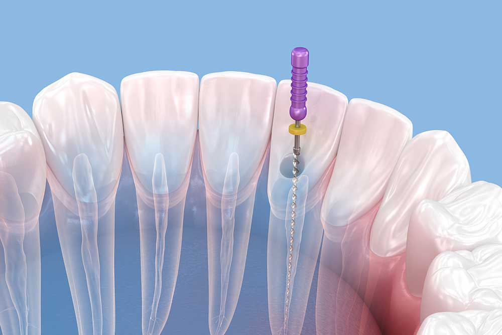 Image hover effect image